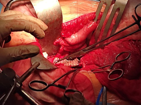 Відгук учасниці програми Еразмус+ Шубіної Олександри