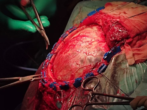 Відгук учасниці програми Еразмус+ Шубіної Олександри